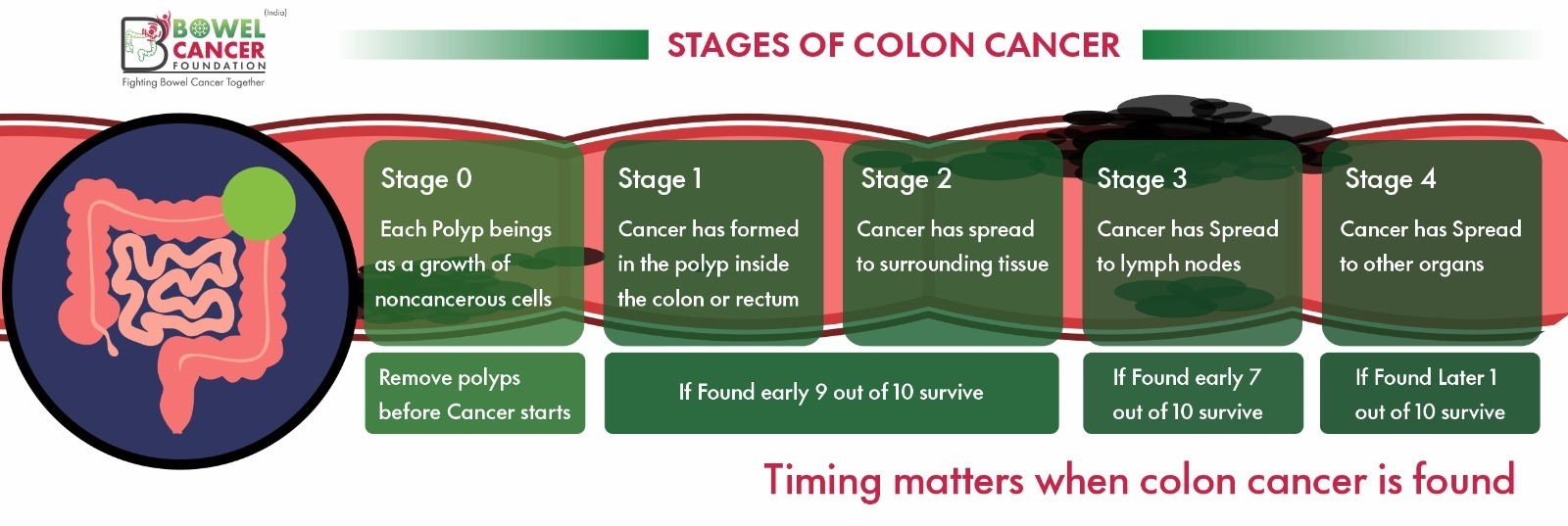 bowel cancer stage 4 survival rate